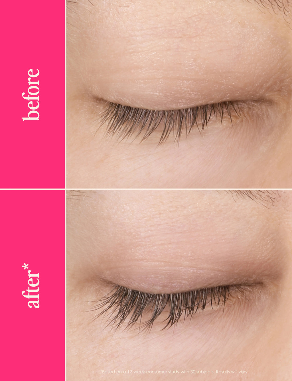 GrandeLASH-MD 2mL, 3-month supply