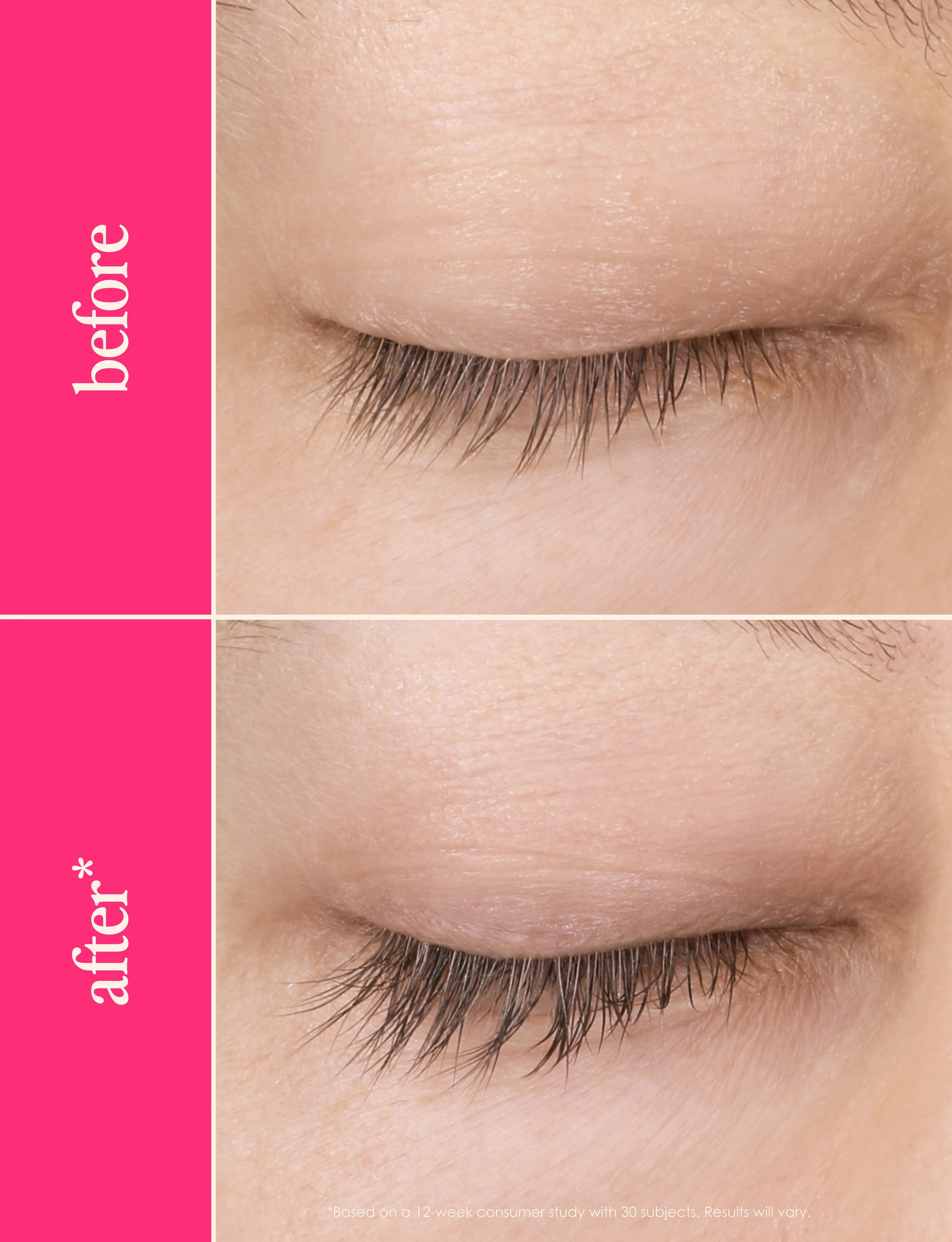 GrandeLASH-MD 2mL, 3-month supply