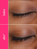 GrandeLASH-MD 2mL, 3-month supply